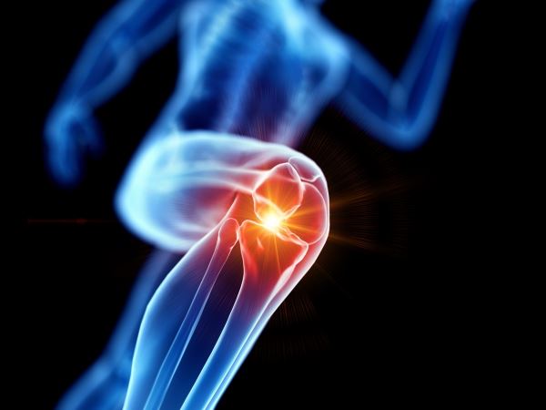 Воспаление колена: причины, симптомы и лечение